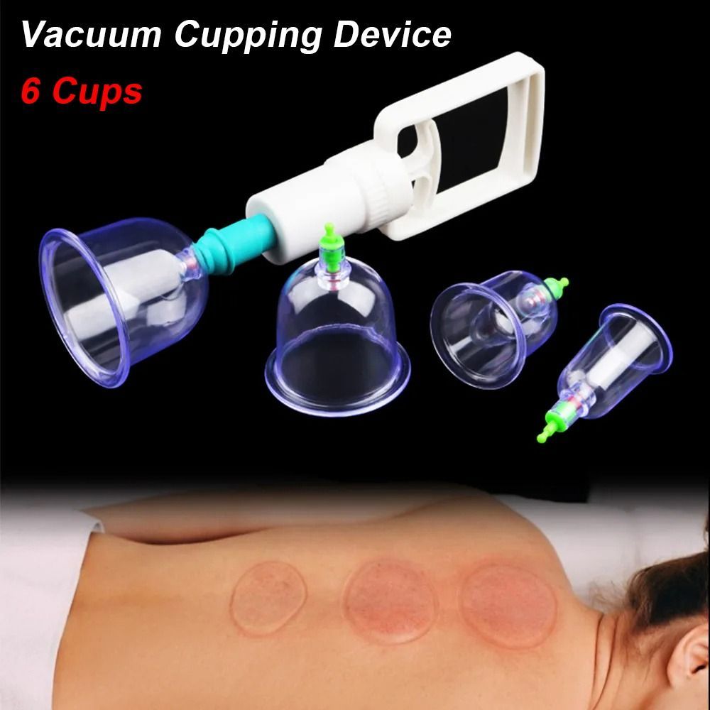 8Pcs/Set Anti-cellulite Vacuum - Cupping Therapy Set review and price